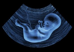 ultrasound baby